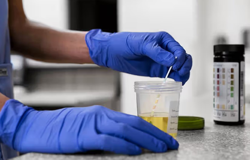 synthetic product urine testing