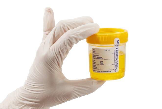 synthetic urine test