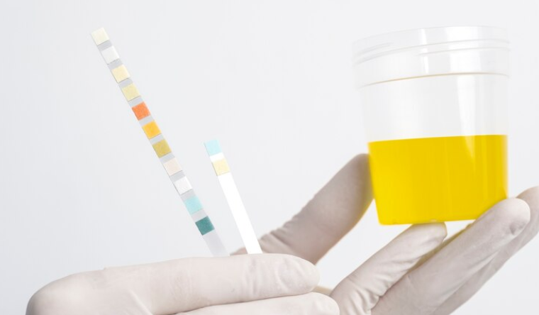 The Best Synthetic Urine Products to Pass a Drug Test