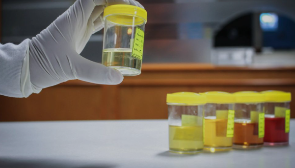 Synthetic urine top 5 synthetic urine products